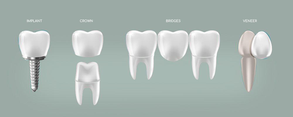 Best Crowns and Bridges Treatment in Gurgaon